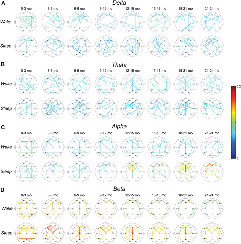 Evolution of Cortical Functional Networks in Healthy Infants
